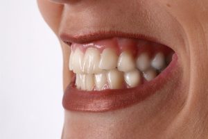 Zähneknirschen: Zahnarztpraxis Jolanta Lange