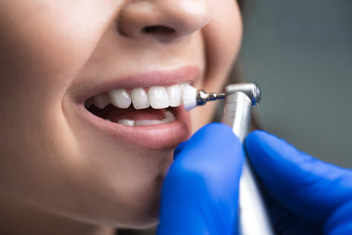 Professionelle Zahnreinigung Zahnarztpraxis Lange M 252 nchen